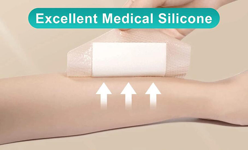 The Action Mechanism and Application of Closed Wound Dressing